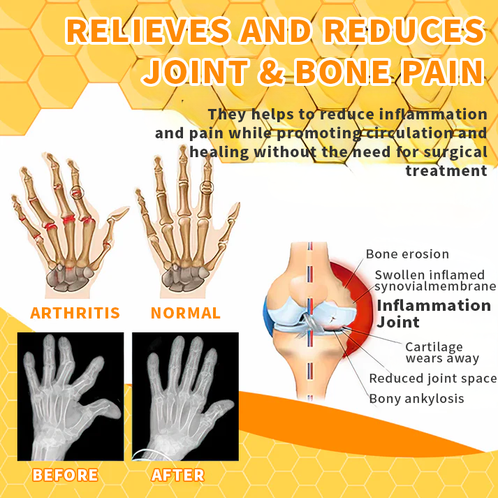 TAILEDEN™  Bee Venom Joint Therapy Pain Relief Gel