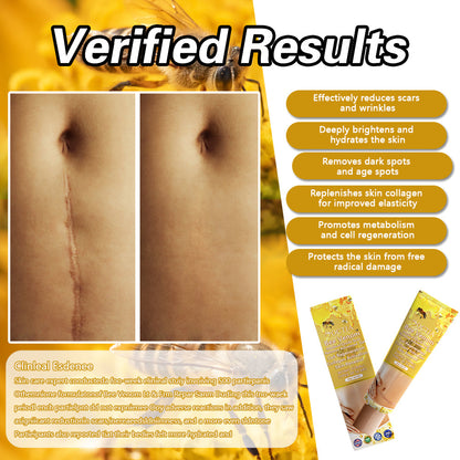 🐝DOCTIA™ Bee Venom Medical Grade Scar Remove Advanced  Gel(🔥🔥FOR ALL SCAR TYPES)