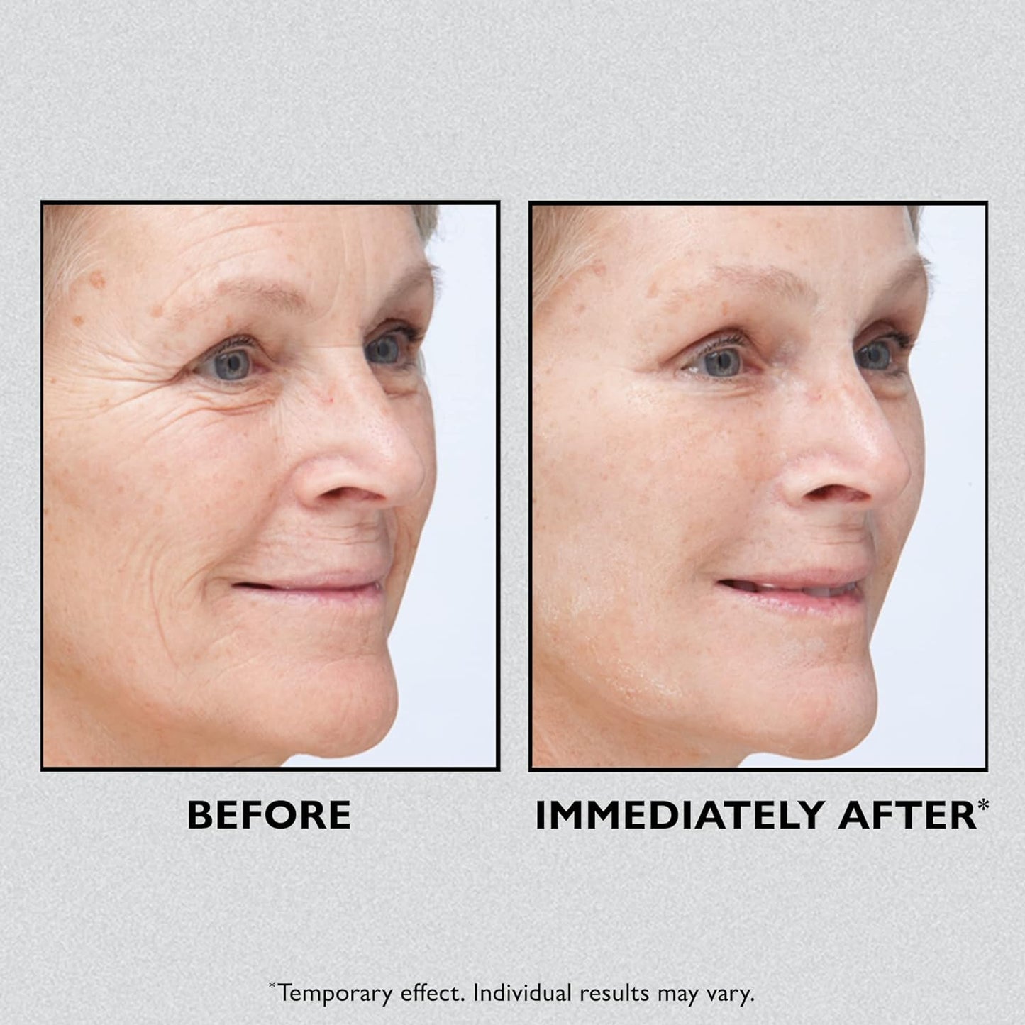 🎁Today 49% OFF🎁Temporary Face Tightener