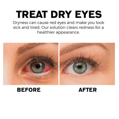 LAST DAY SALE-50% OFF) ATTDX Treatment EyeProblems SolutionDrops (CD – 01)